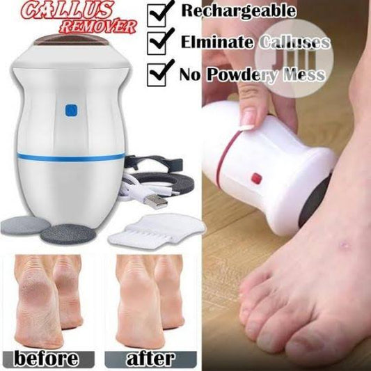 Callus Remover