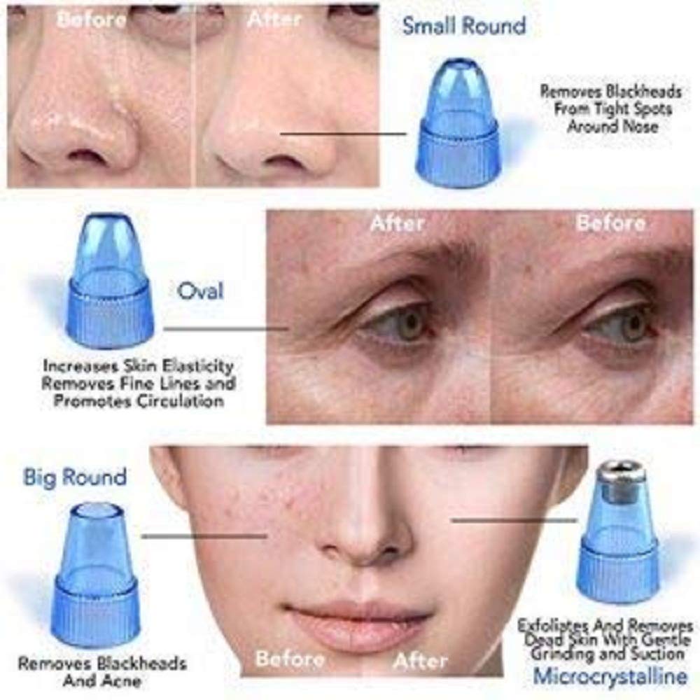 Derma Suction Vacuum