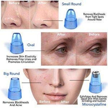 Derma Suction Vacuum