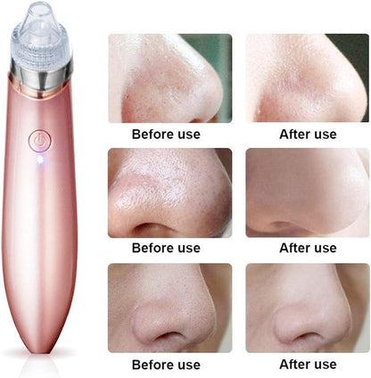 Blackhead Suction Machine
