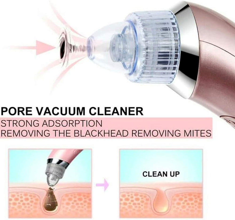 Blackhead Suction Machine