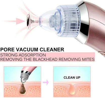 Blackhead Suction Machine